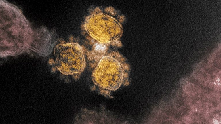 No hay evidencia que mutación de coronavirus sea más leve en personas, afirma OMS